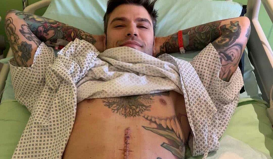 Fedez Surgery